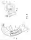 Fig. 09 - Percutaneous intra-aortic ventricular assist device