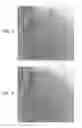 Fig. 03 - Automatic correction and utilization of a vascular roadmap comprising a tool
