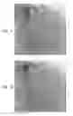 Fig. 04 - Automatic correction and utilization of a vascular roadmap comprising a tool