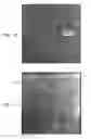 Fig. 07 - Automatic correction and utilization of a vascular roadmap comprising a tool