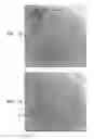 Fig. 08 - Automatic correction and utilization of a vascular roadmap comprising a tool