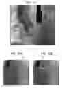 Fig. 22 - Automatic correction and utilization of a vascular roadmap comprising a tool