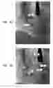 Fig. 23 - Automatic correction and utilization of a vascular roadmap comprising a tool