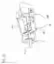 Fig. 56 - Catheter and Introducer Needle Assembly with Needle Shield