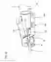 Fig. 57 - Catheter and Introducer Needle Assembly with Needle Shield