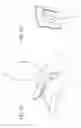 Fig. 63 - Catheter and Introducer Needle Assembly with Needle Shield