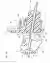 Fig. 75 - Catheter and Introducer Needle Assembly with Needle Shield