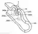 Fig. 01 - SURGICAL INSTRUMENTS AND TECHNIQUES FOR TREATING GASTRO-ESOPHAGEAL REFLUX DISEASE