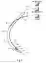 Fig. 02 - SURGICAL INSTRUMENTS AND TECHNIQUES FOR TREATING GASTRO-ESOPHAGEAL REFLUX DISEASE