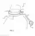 Fig. 02 - Assembly and method for automatically controlling pressure for a gastric band