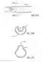 Fig. 25 - Assembly and method for automatically controlling pressure for a gastric band