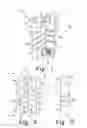 Fig. 02 - Flexible and static interspinous/inter-laminar spinal spacers