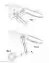 Fig. 02 - Knife and device assembly