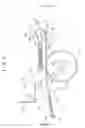 Fig. 07 - Brake system of chain saw and chain saw
