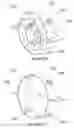 Fig. 15 - Rotary energy conversion device with reciprocating pistons