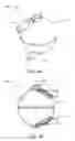 Fig. 09 - Blood treatment systems and methods