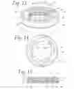 Fig. 06 - Injector mounting system