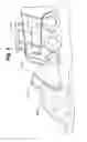 Fig. 08 - EROSION CONTROL DEVICE