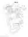 Fig. 04 - Vehicle disc brake device