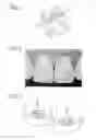 Fig. 02 - Advanced Thermoplastics for Orthodontics