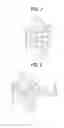 Fig. 04 - Advanced Thermoplastics for Orthodontics