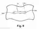 Fig. 08 - Utility cart assembly