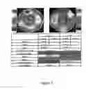 Fig. 07 - System and method for analyzing wavefront aberrations