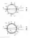 Fig. 04 - X-ray flux management device