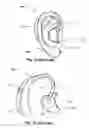 Fig. 02 - Electrical Connector for a Hearing Device