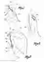 Fig. 07 - Hearing Aid