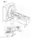 Fig. 02 - CT image recording of a moving examination object