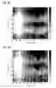 Fig. 07 - CT image recording of a moving examination object