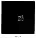 Fig. 09 - Image reconstructing method using X-ray volume photography