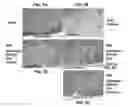 Fig. 06 - Cyclic undecapeptides and derivatives as multiple sclerosis therapies