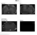 Fig. 09 - Cyclic undecapeptides and derivatives as multiple sclerosis therapies