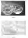 Fig. 10 - Polymer for tissue engineering applications and drug delivery