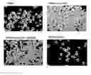Fig. 01 - COMPOSITION FOR TREATING ISCHEMIC LIMB DISEASE COMPRISING STEM CELLS DERIVED FROM ADIPOSE TISSUE