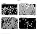 Fig. 04 - COMPOSITION FOR TREATING ISCHEMIC LIMB DISEASE COMPRISING STEM CELLS DERIVED FROM ADIPOSE TISSUE