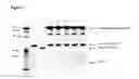 Fig. 10 - Methods for screening candidate agents for modulating prorenin and renin, assays for detecting prorenin and antibodies