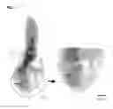 Fig. 06 - Babesia Subtilisin
