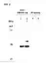 Fig. 07 - Babesia Subtilisin