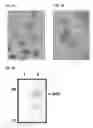 Fig. 08 - Babesia Subtilisin
