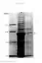 Fig. 02 - Tick galectin
