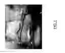 Fig. 02 - PREVASCULARIZED DEVICES AND RELATED METHODS