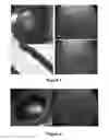 Fig. 07 - MATERIALS AND METHODS FOR DELIVERING COMPOSITIONS TO SELECTED TISSUES