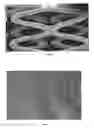 Fig. 02 - MEDICAL DEVICES HAVING A SURFACE INCLUDING A BIOLOGICALLY ACTIVE AGENT THEREIN
