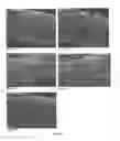 Fig. 09 - MEDICAL DEVICES HAVING A SURFACE INCLUDING A BIOLOGICALLY ACTIVE AGENT THEREIN