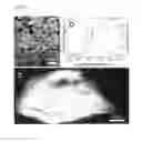 Fig. 02 - Implant material