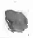 Fig. 32 - Treatment of Wounds and Compositions Employed