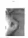 Fig. 35 - Treatment of Wounds and Compositions Employed